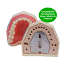 DENTOFORMO 101-IMA DENTISTICA IMANTADO ORAIS