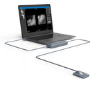 SENSOR DIGITAL DE RAYOS X XVD2121 XPECT VISION