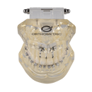 DENTOFORMO MODELO ORTODONTICO ICERAM-P/ICECLEAR/ADVANCED/U-CLIP ORTHOMETRIC